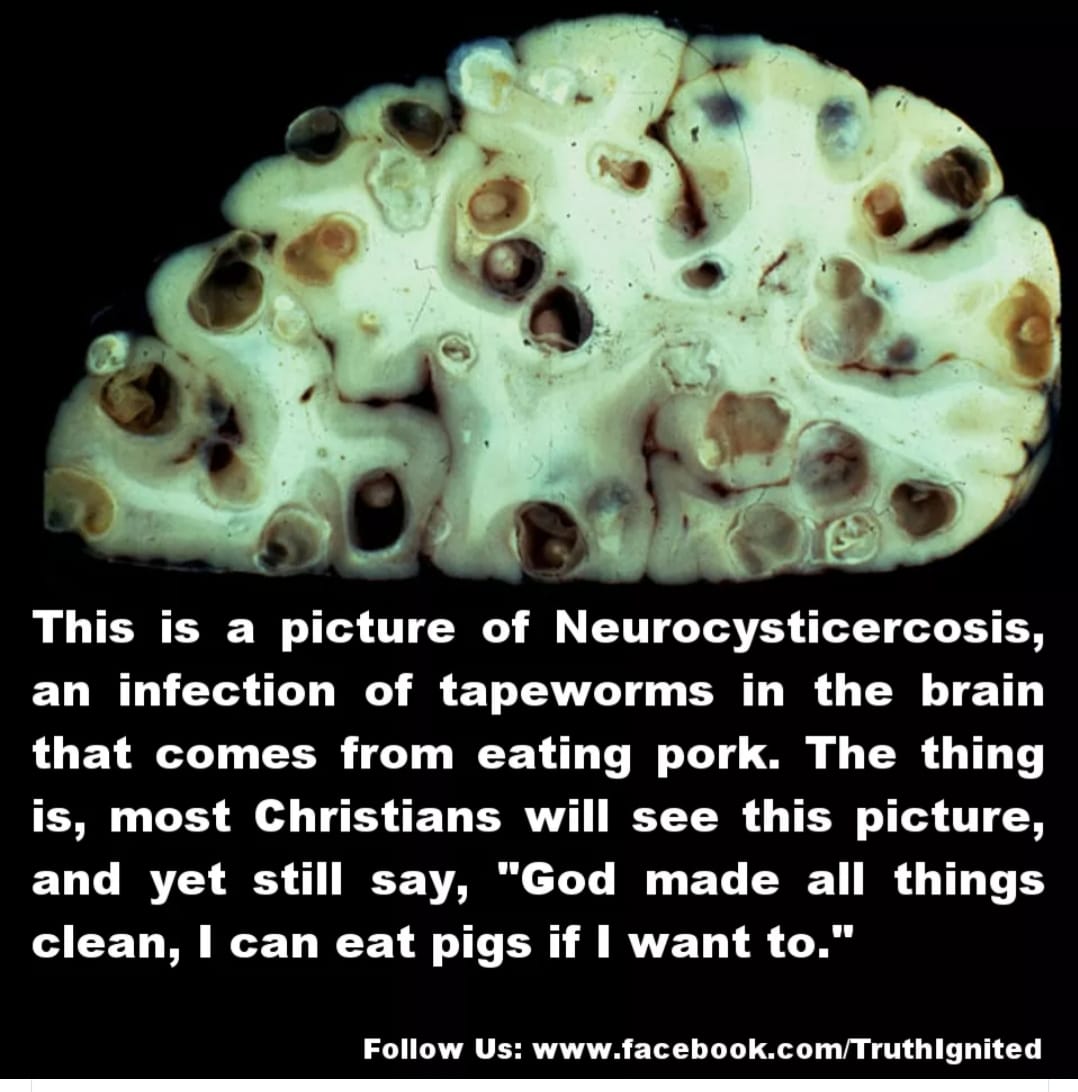 brain parasites from pork